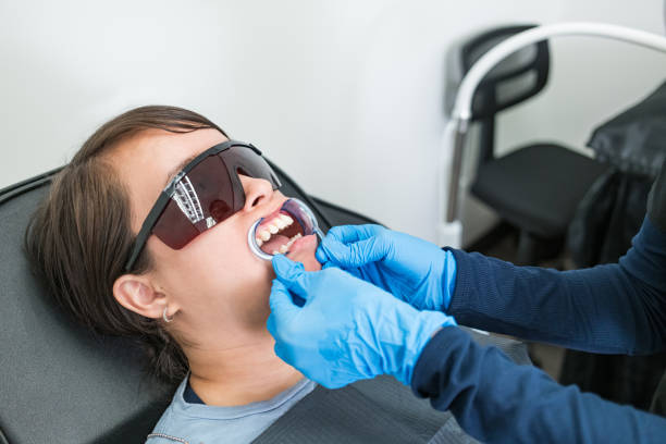 Teeth Whitening in AL