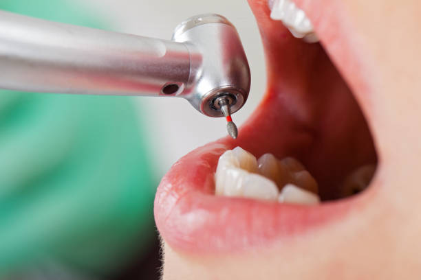 Best Tooth Pain Emergency Relief  in Bay Minette, AL